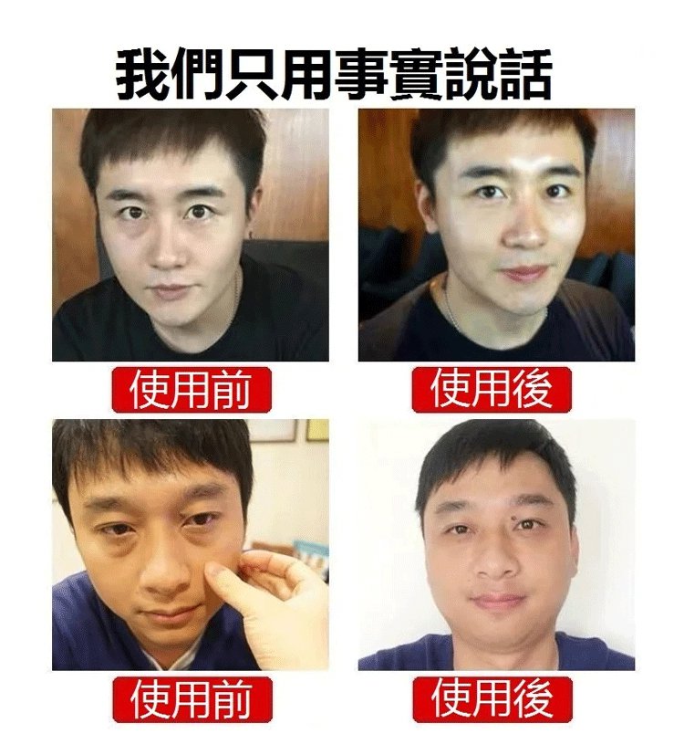 膠原蛋白填充霜 膠原蛋白填充霜