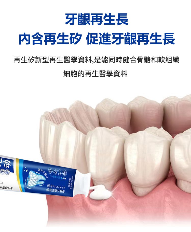 牙齒晃動牙膏 14 53e5a5575bf36f7f987319e576a2213f 牙齒晃動牙膏