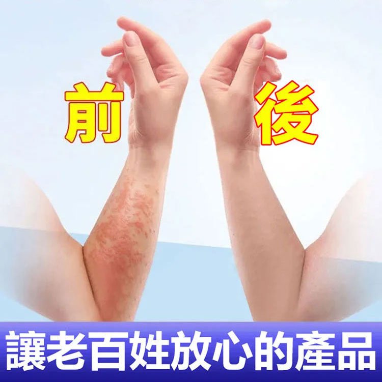 South Moon手蘚腳氣噴霧 32 573b5eb43a2653e2a2cc5b0c1d317de9 South Moon手蘚腳氣噴霧