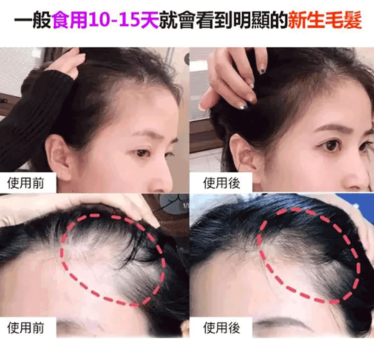 五珍芝麻丸 五珍芝麻丸