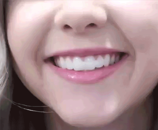 可塑性牙膠 5 5f4a6044f7709ff1db6264d30377a51f 可塑性牙膠