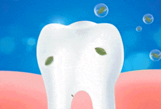 可塑性牙膠 28 601b013782a0716f546852503656ff99 可塑性牙膠