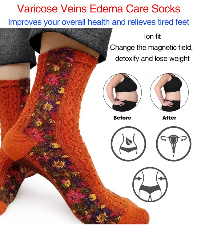 Varicose Veins Edema Care Socks