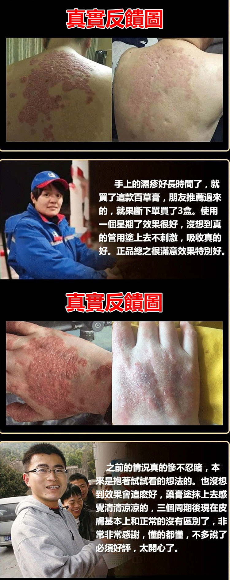 頑毒淨乳膏頑達康日本配方 8 63897c1609f1066d3bc61cb6b5e2e94b 頑毒淨乳膏頑達康日本配方