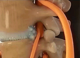 祖醫堂腰椎冷敷凝膠 12 64dfd6e56146decc98062d19b4f72e6e 祖醫堂腰椎冷敷凝膠