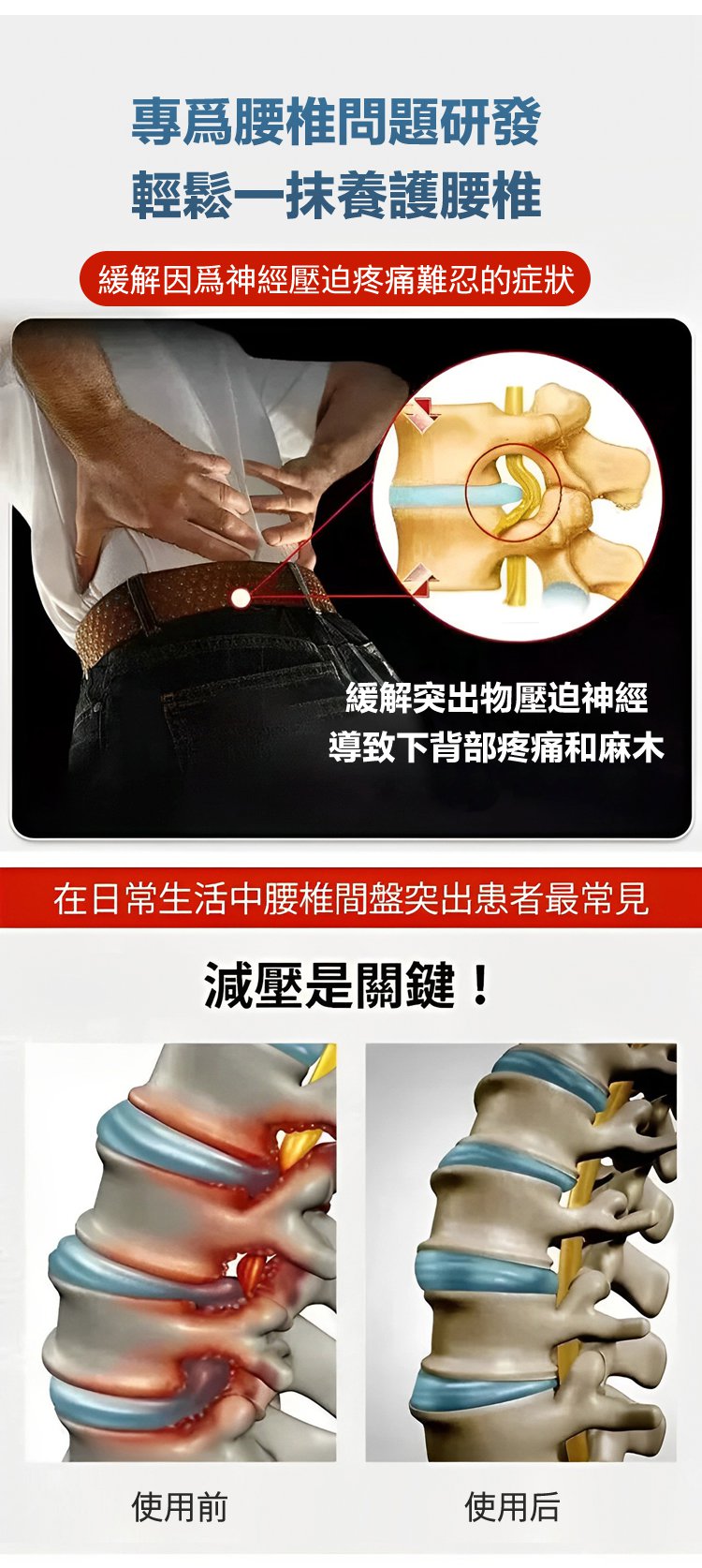 祖醫堂腰椎冷敷凝膠 9 725ca596427161dcbc60a859d50fa370 祖醫堂腰椎冷敷凝膠