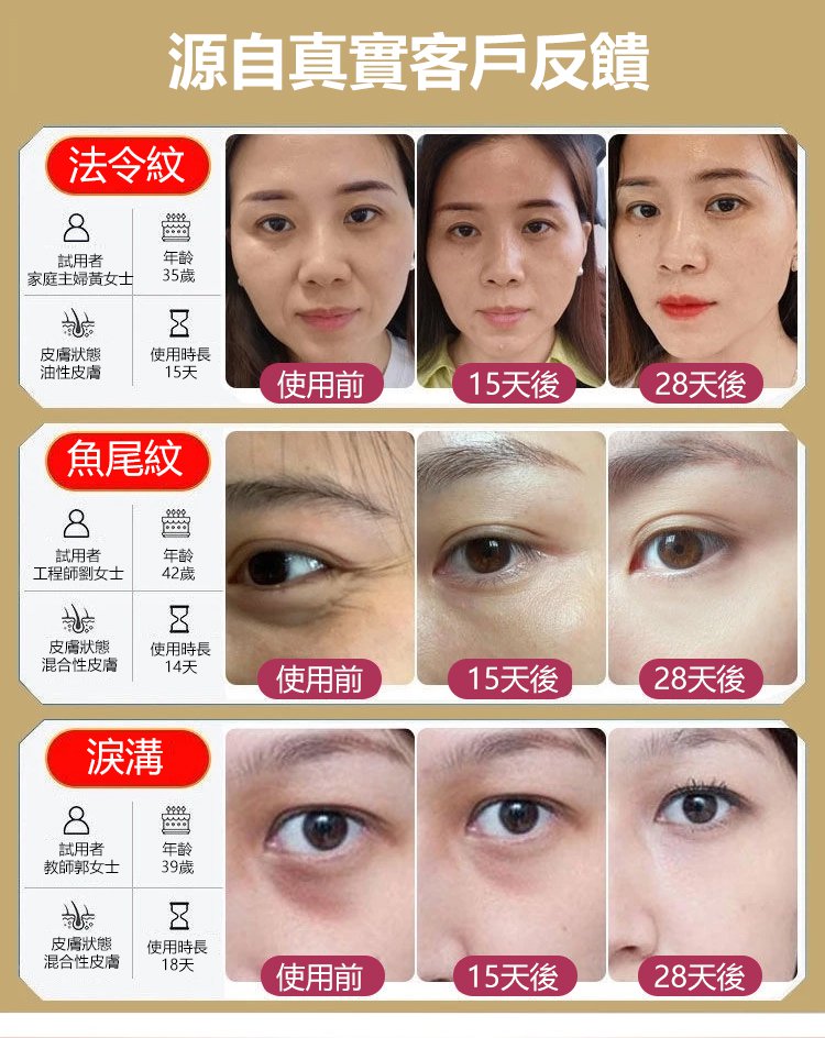 膠原蛋白填充霜