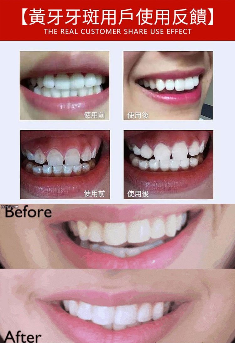 可立克蜂毒牙膏