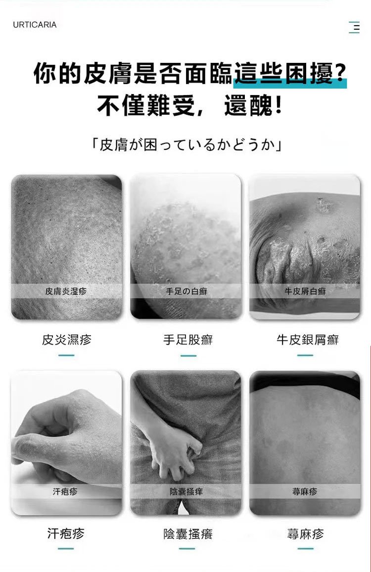 South Moon手蘚腳氣噴霧 4 82229299bcda4d02616ac9e846400cf7 South Moon手蘚腳氣噴霧