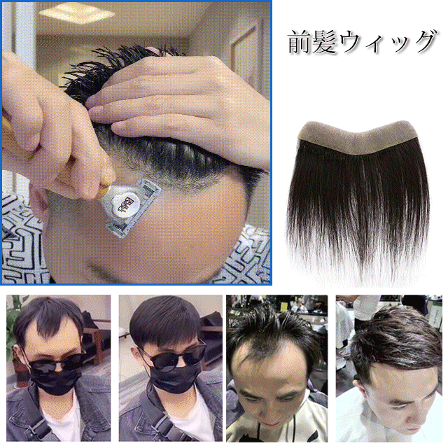 メンズ前髪ウィッグ Mirabeleshop Com