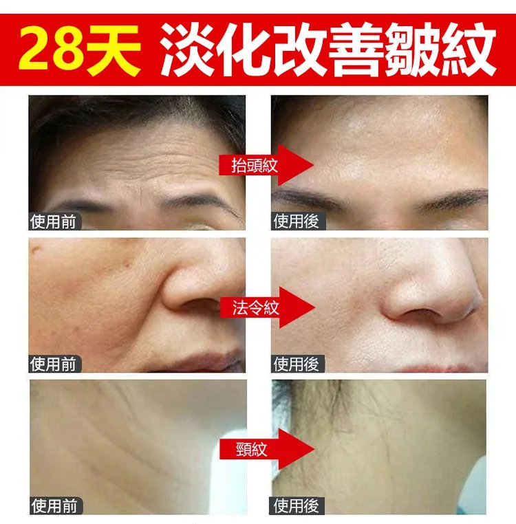 膠原蛋白填充霜