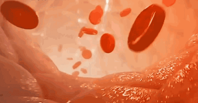 醫療用護腰帶 23 f9f4094208fd2230fcb62dc662f0c971.gif