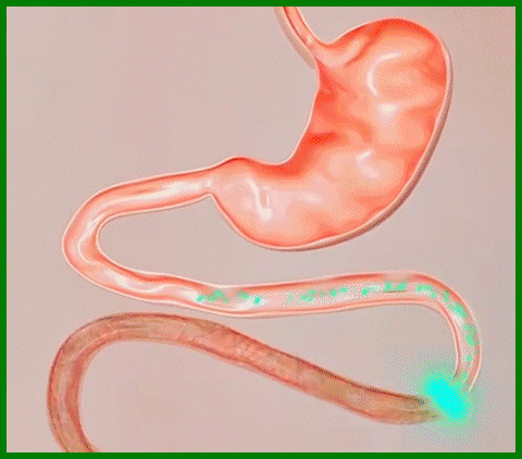 【潤腸通便】李時珍清青膠囊 11 1-(2).gif