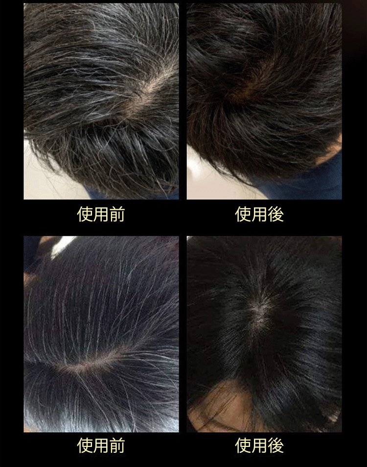 南京同仁堂靈芝人參何首烏白轉黑洗髮皂何首烏洗髮皂洗頭側柏葉洗髮皂手工皂角中藥純天然頭髮白轉黑皂100克每盒 南京同仁堂靈芝人參何首烏白轉黑洗髮皂