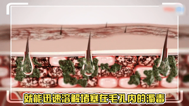 頑毒淨乳膏頑達康日本配方 4 a7fc50d5d501f9d171a5844f27a2d321 頑毒淨乳膏頑達康日本配方