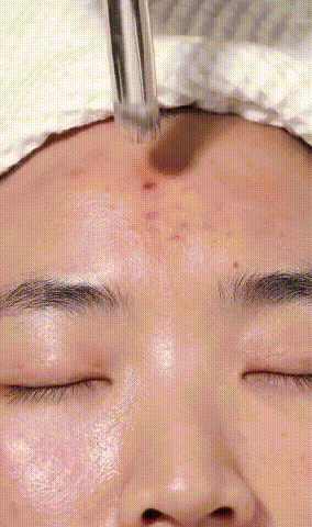 NOVO強力遮瑕膏 22 a8aa5ad99852a071662e61d3bb6cccbd NOVO強力遮瑕膏