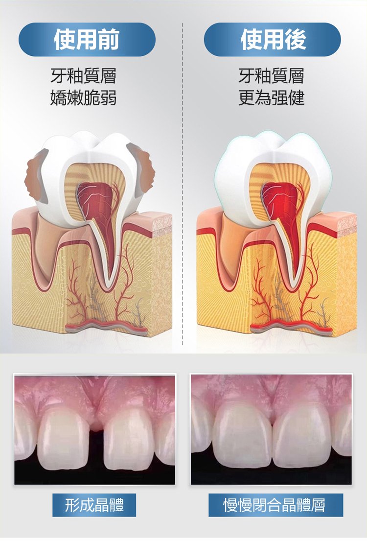 牙齒晃動牙膏 20 b17fb5ba1bf815c99a5056d97a69ac70 牙齒晃動牙膏