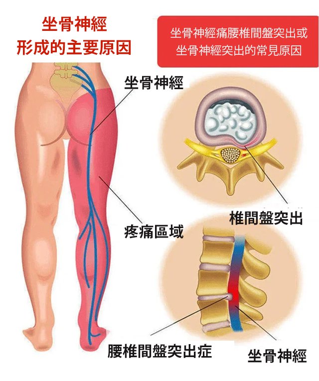 寶元堂腰椎冷敷凝膠