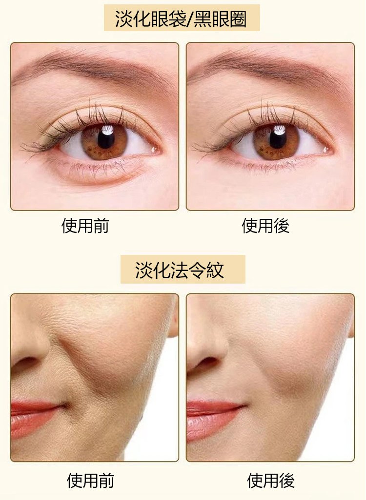 膠原蛋白填充霜 膠原蛋白填充霜