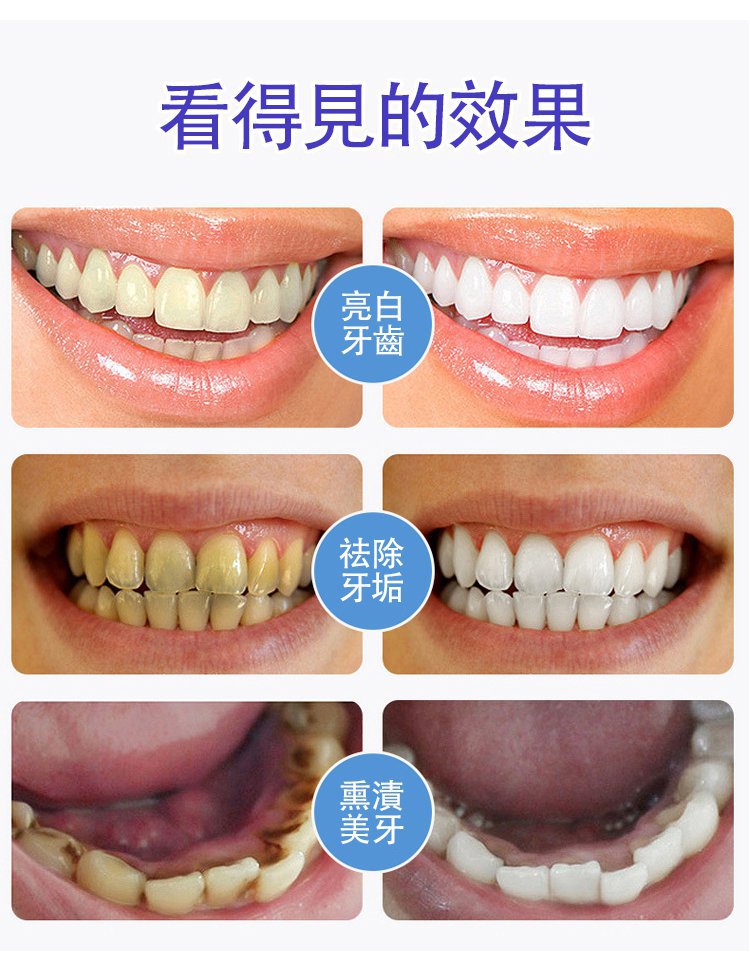 BisuTang益生菌牙膏 30 bcdf70be5e9da082d00ffb7584cbe48e BisuTang益生菌牙膏