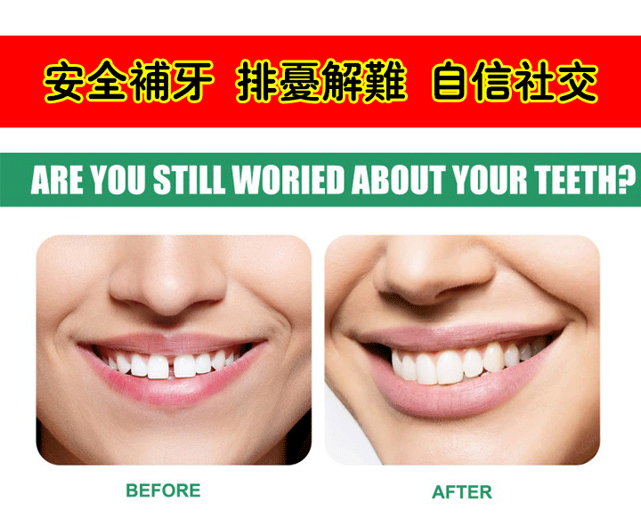 可塑性牙膠 31 c092c877810547c1e8be29b8e44c1870 可塑性牙膠