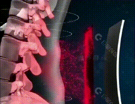 蒙澳神遠紅外腰椎貼