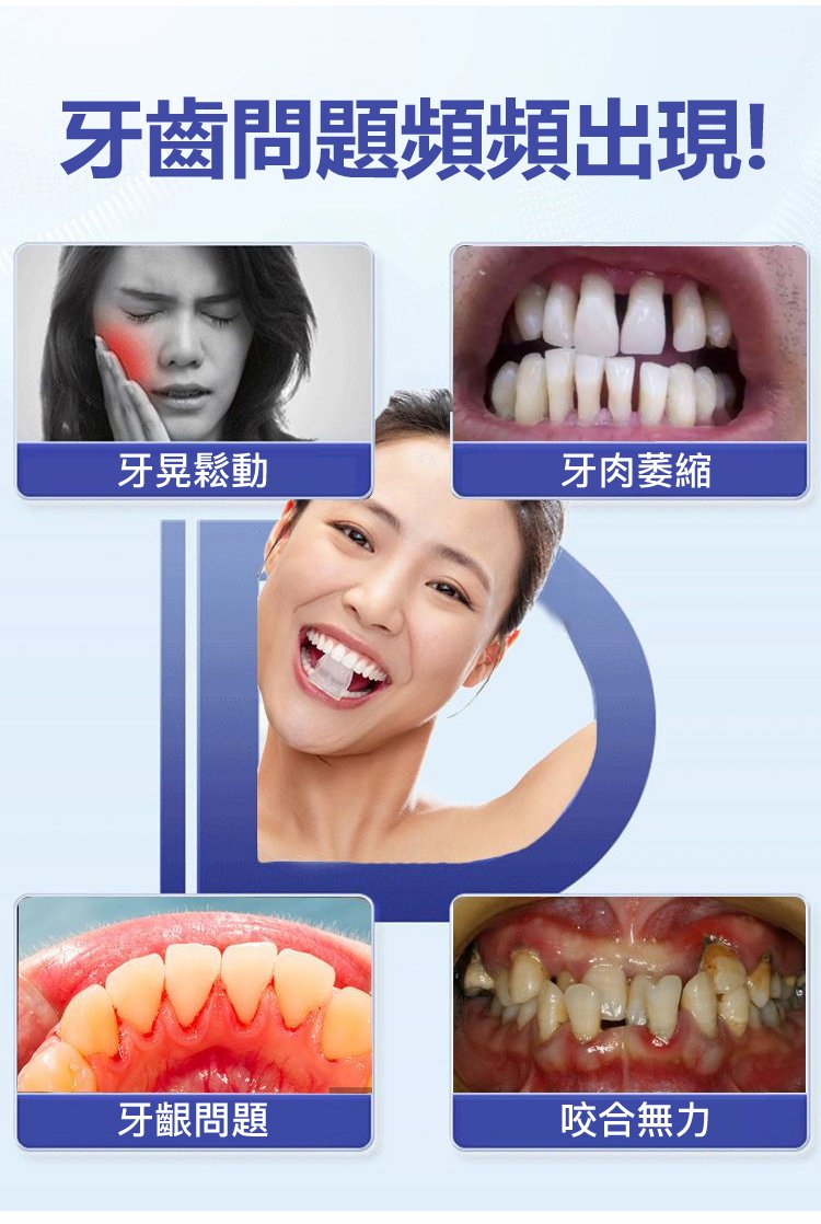 牙齒晃動牙膏 9 d1d96a7afaa244d0daf208a0052446be 牙齒晃動牙膏