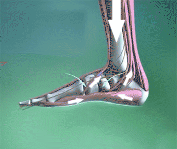 d3a91a392ce2bddf78fa5a2ccafdf344 新繃帶足弓支撐墊