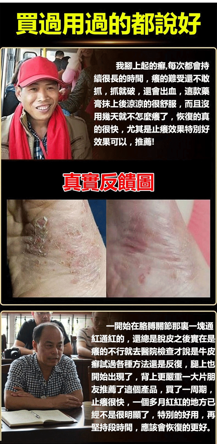 頑毒淨乳膏頑達康日本配方 7 daf5bd537bcb9946a6058b67ccd95857 頑毒淨乳膏頑達康日本配方