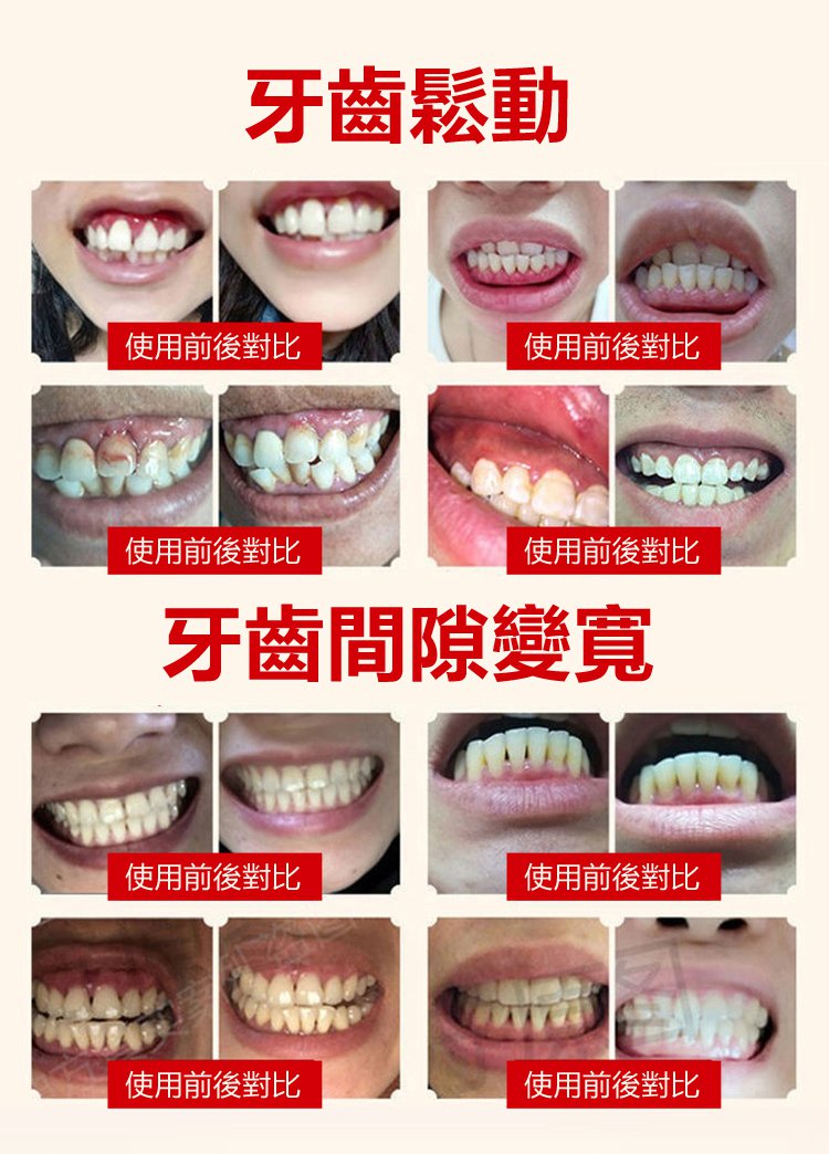 牙齒晃動牙膏 3 db58185d3c6a5219eee6b8c633d53336 牙齒晃動牙膏