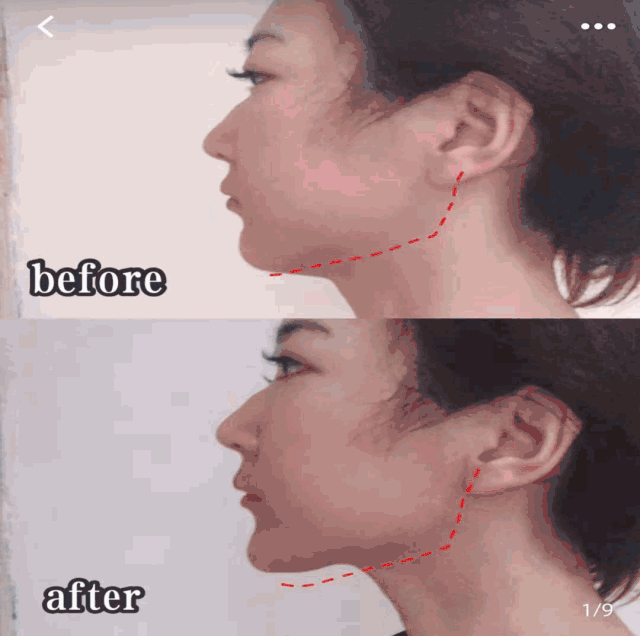 陳皮山楂薏仁軟糖