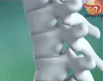 醫療用護腰帶 13 f8060a9e024d169010ac6f349335102d.gif