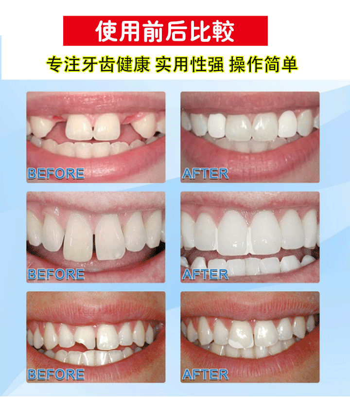 可塑性牙膠 29 e62f26c59c9cea2085b043985013f172 可塑性牙膠