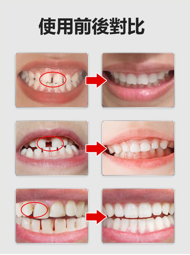 牙齒晃動牙膏 24 e63a4e39efb9215b33606ed440232a61 牙齒晃動牙膏