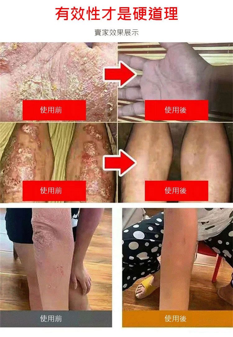 South Moon手蘚腳氣噴霧 35 ea650427f0d38da9a8d4cc81de3bbf9c South Moon手蘚腳氣噴霧