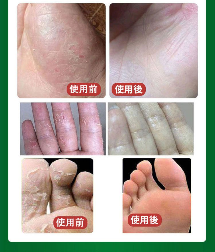 South Moon手蘚腳氣噴霧 19 f069271895977bb877bf83505fb14e8b South Moon手蘚腳氣噴霧