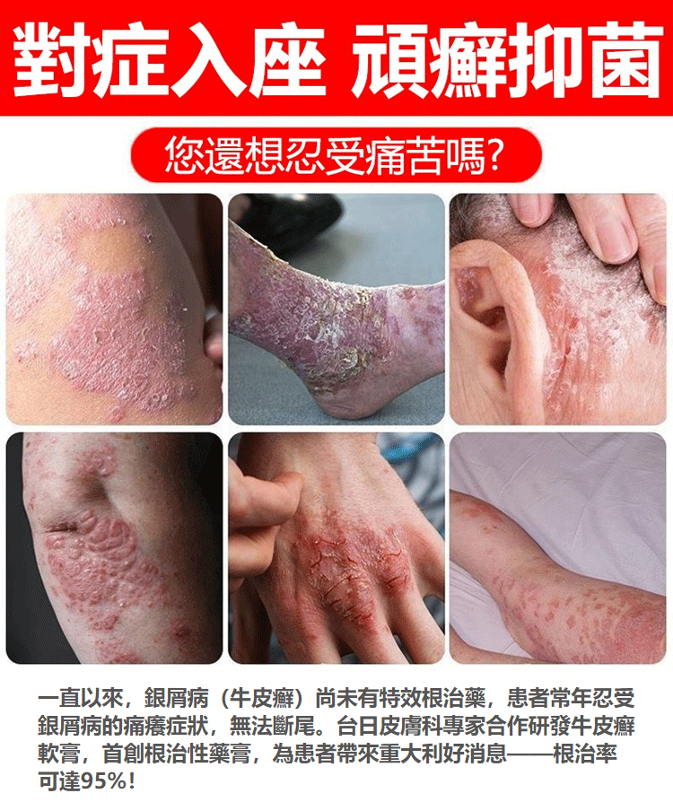 頑毒淨乳膏頑達康日本配方 2 f258d8d8bc674cfcf9267572f24c8cde 頑毒淨乳膏頑達康日本配方