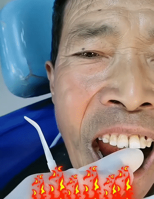 牙齒晃動牙膏 10 f441edb7b43640ac40b9d33a2794f2df 牙齒晃動牙膏