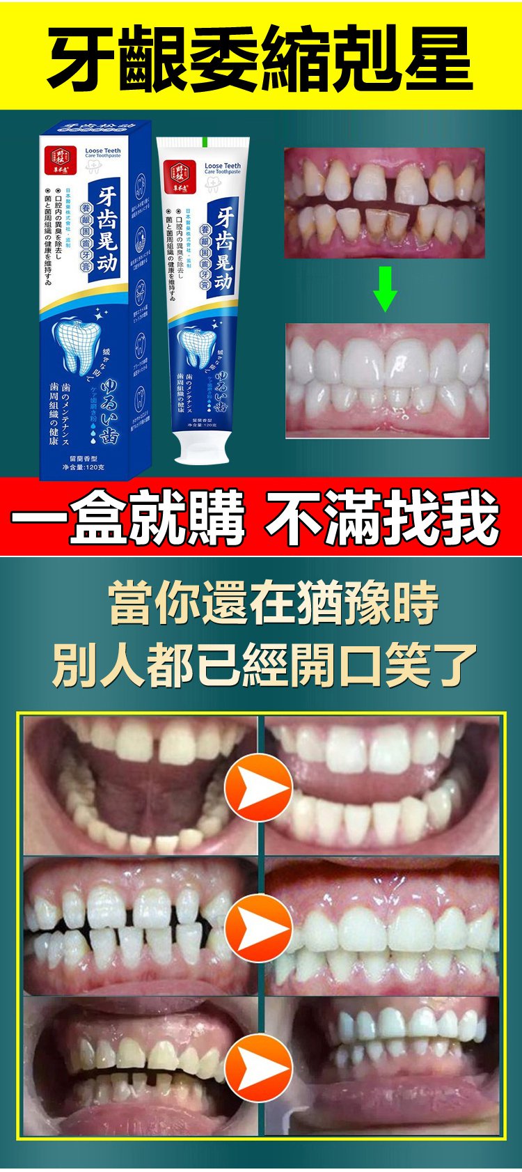 牙齒晃動牙膏 1 f517e973639b60192e6f91d3686f5ff0 牙齒晃動牙膏