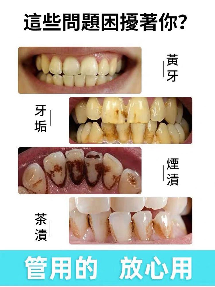 可立克蜂毒牙膏